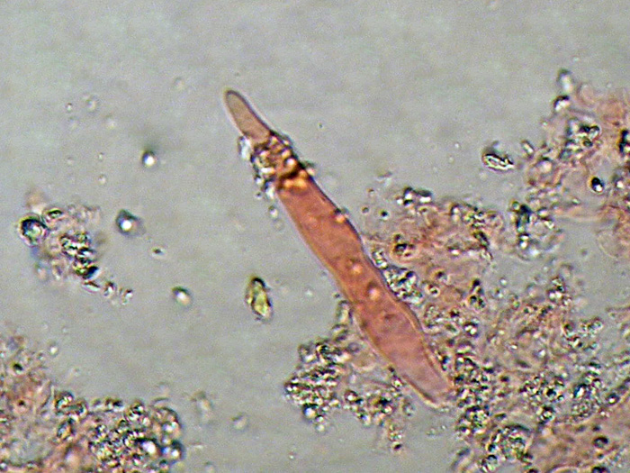 Penso ad un Vuilleminia sp-foto5046 (Vuilleminia cystidiata)